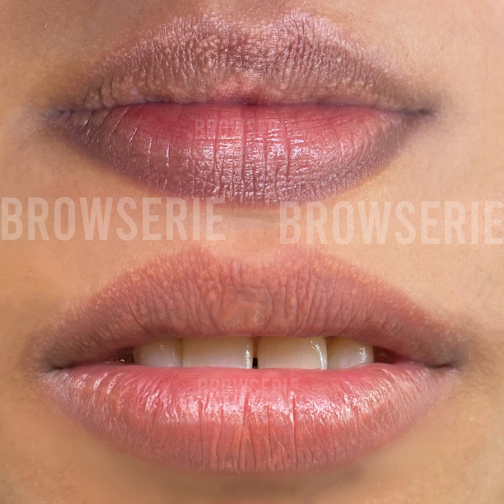 Dark Lip Neutralisation Course