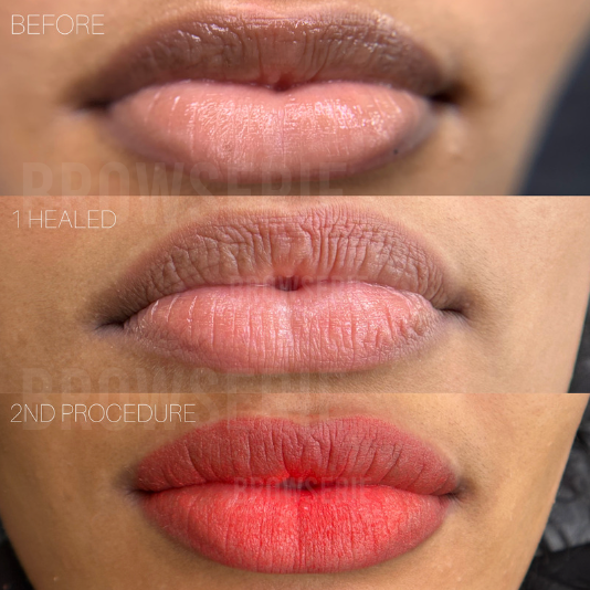 Dark Lip Neutralisation Course
