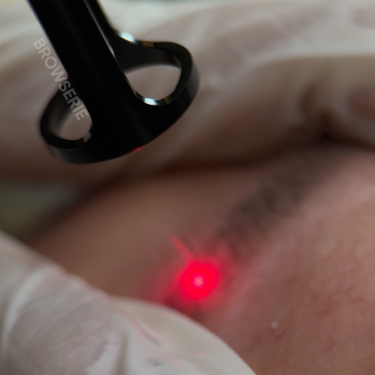 Removal for Eyebrow / Eyeliner Tattoo
