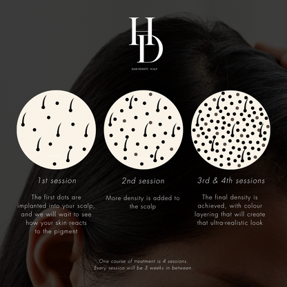 HD Scalp (4 sessions)