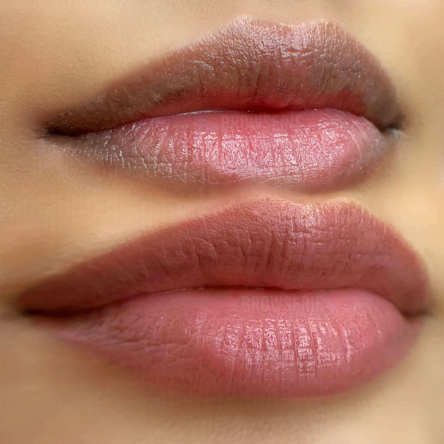 Dark Lip Neutralisation (2 sessions)