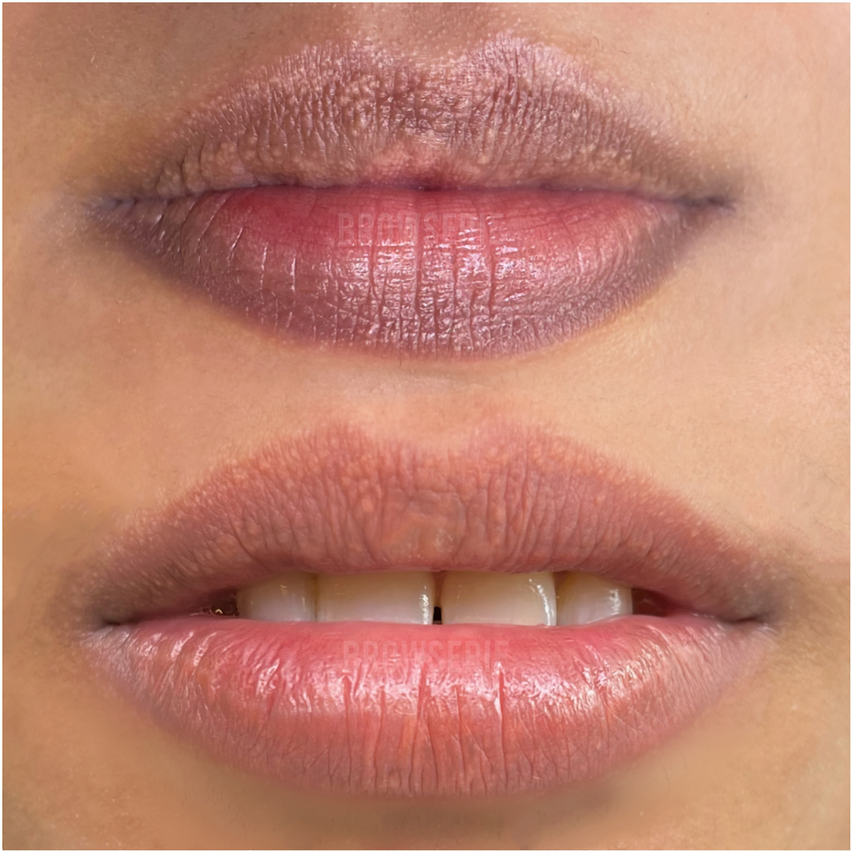 Dark Lip Neutralisation BROWSERIE