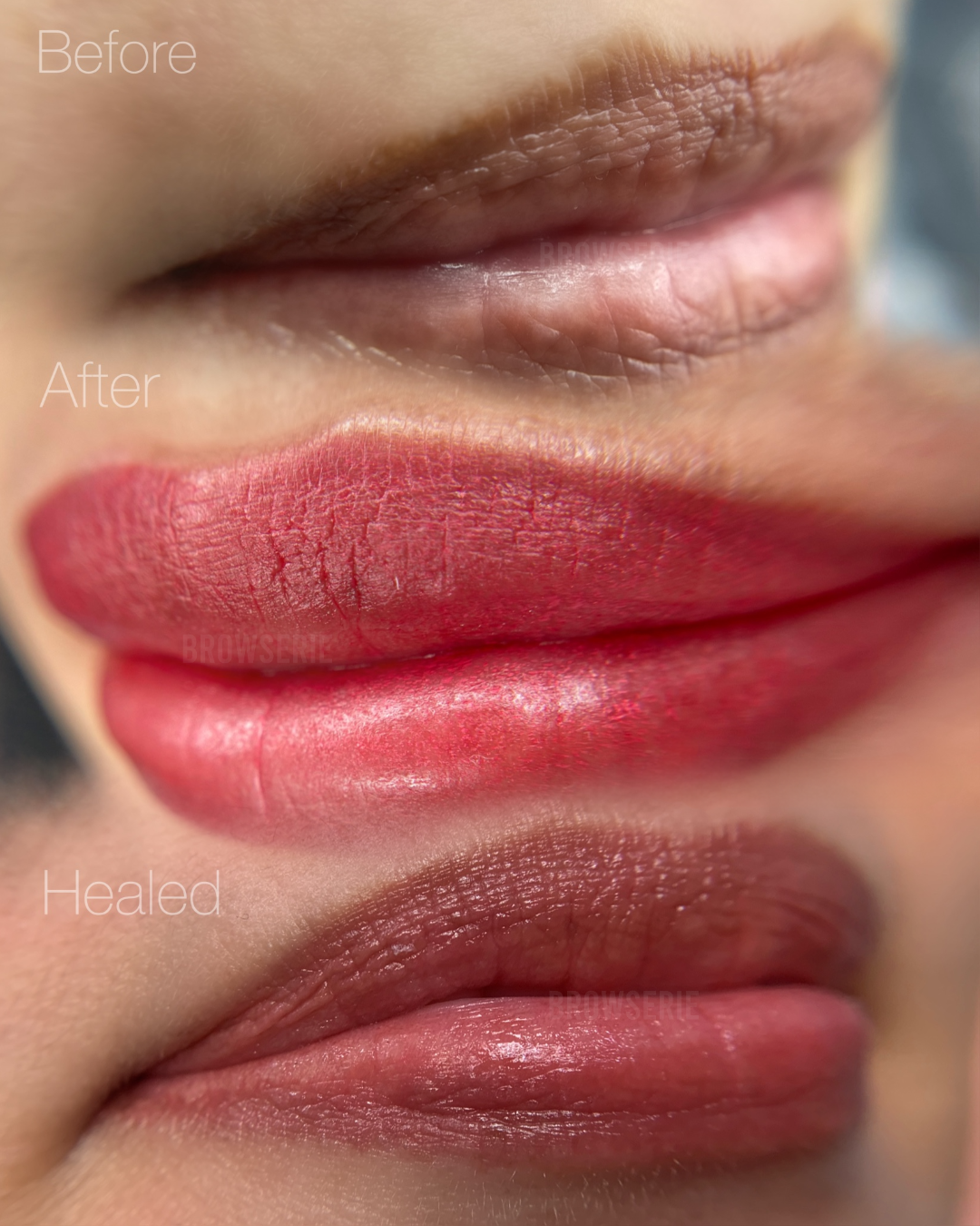 Dark Lip Neutralisation BROWSERIE